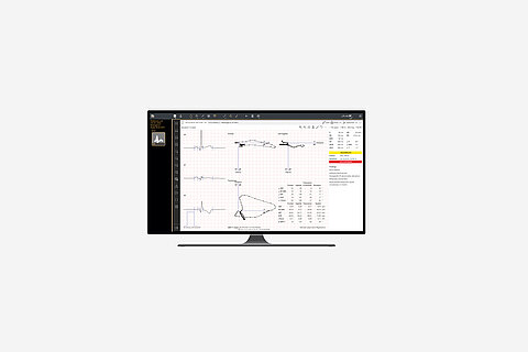 EKG-Befundung: JiveX ECG Advanced mit neuen Funktionen EKG-Befundung: JiveX ECG Advanced mit neuen Funktionen