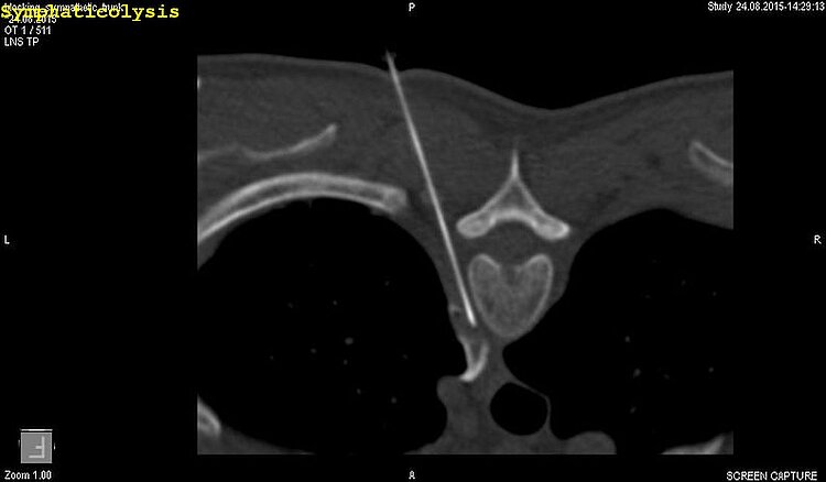 Diagnostischen Radiologie mit JiveX Enterprise PACS 