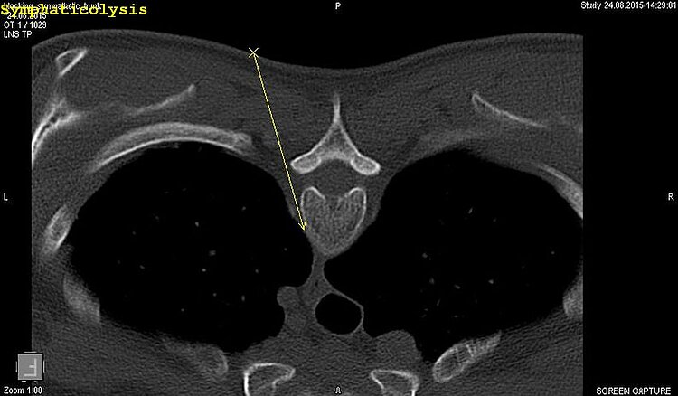 Diagnostischen Radiologie mit JiveX Enterprise PACS 